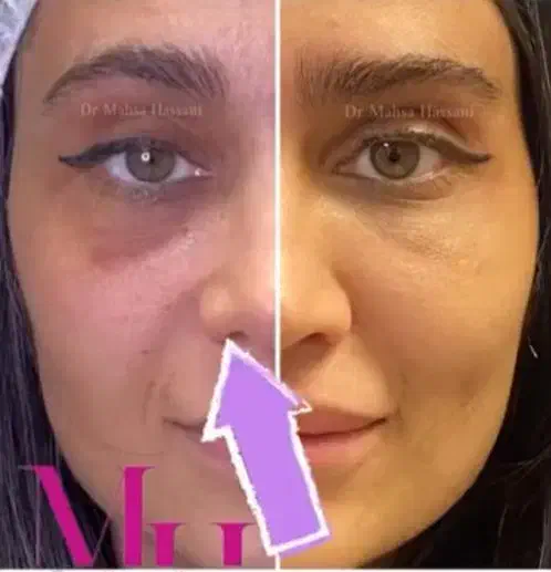 دستیار پزشک زیبایی|استخدام درمانی، زیبایی، بهداشتی|قم, صدوق|دیوار