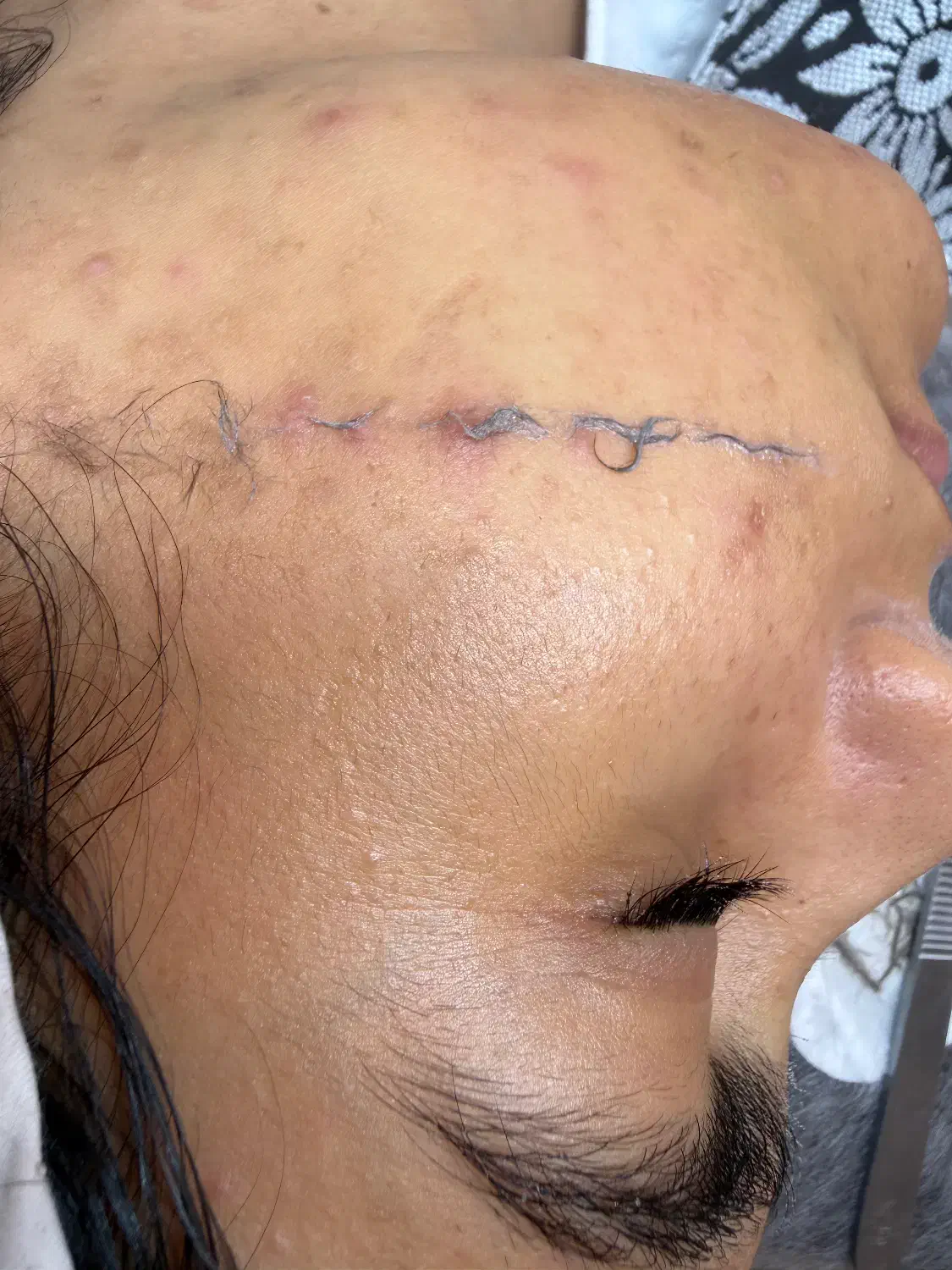 پاکسازی ۱۲مرحله با هدیه درما ۱۹۸ تومان( کلینیک)|خدمات آرایشگری و زیبایی|بیرجند, |دیوار