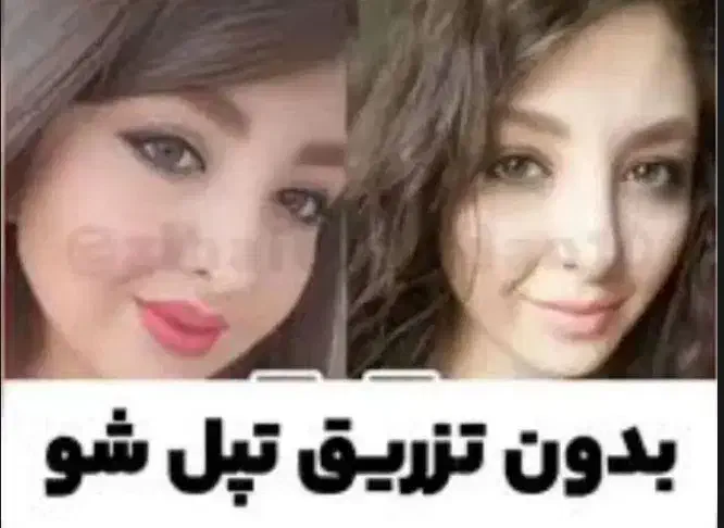 چاقی صورت|آرایشی، بهداشتی، درمانی|اهواز, کیان اباد|دیوار