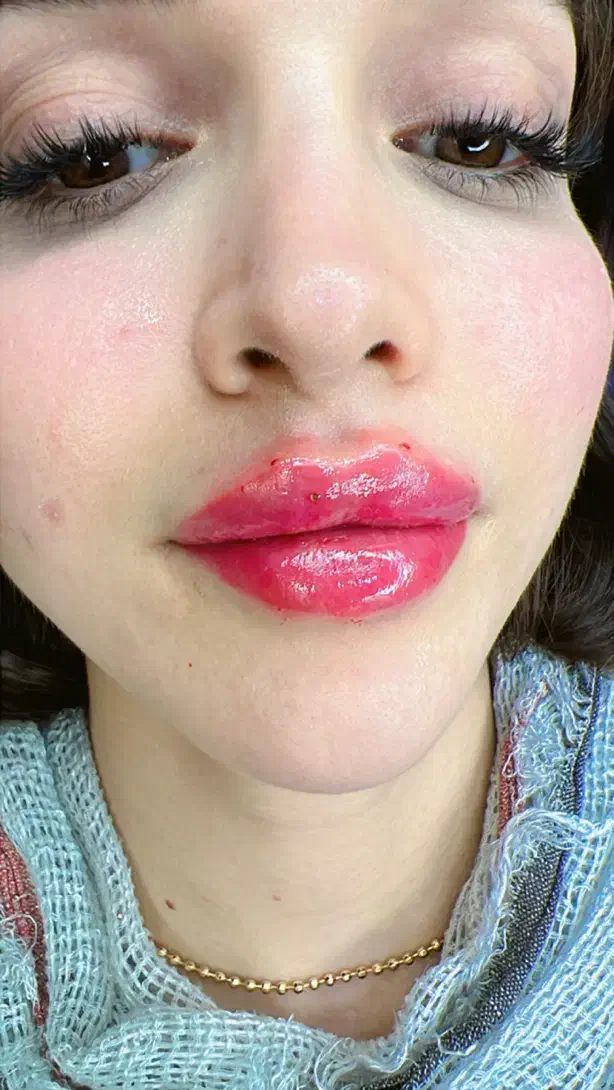 اجاره اتاق لیزر زیبایی فشیال|اجارهٔ دفتر کار، اتاق اداری، مطب|رشت, گلسار|دیوار