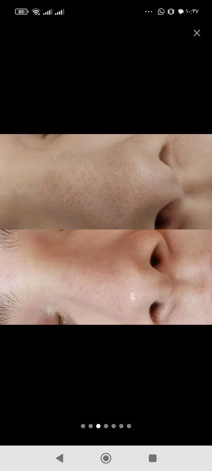 تخفیف ویژه پاکسازی فیشال و کوتاهی مو و شنیون|خدمات آرایشگری و زیبایی|قزوین, |دیوار