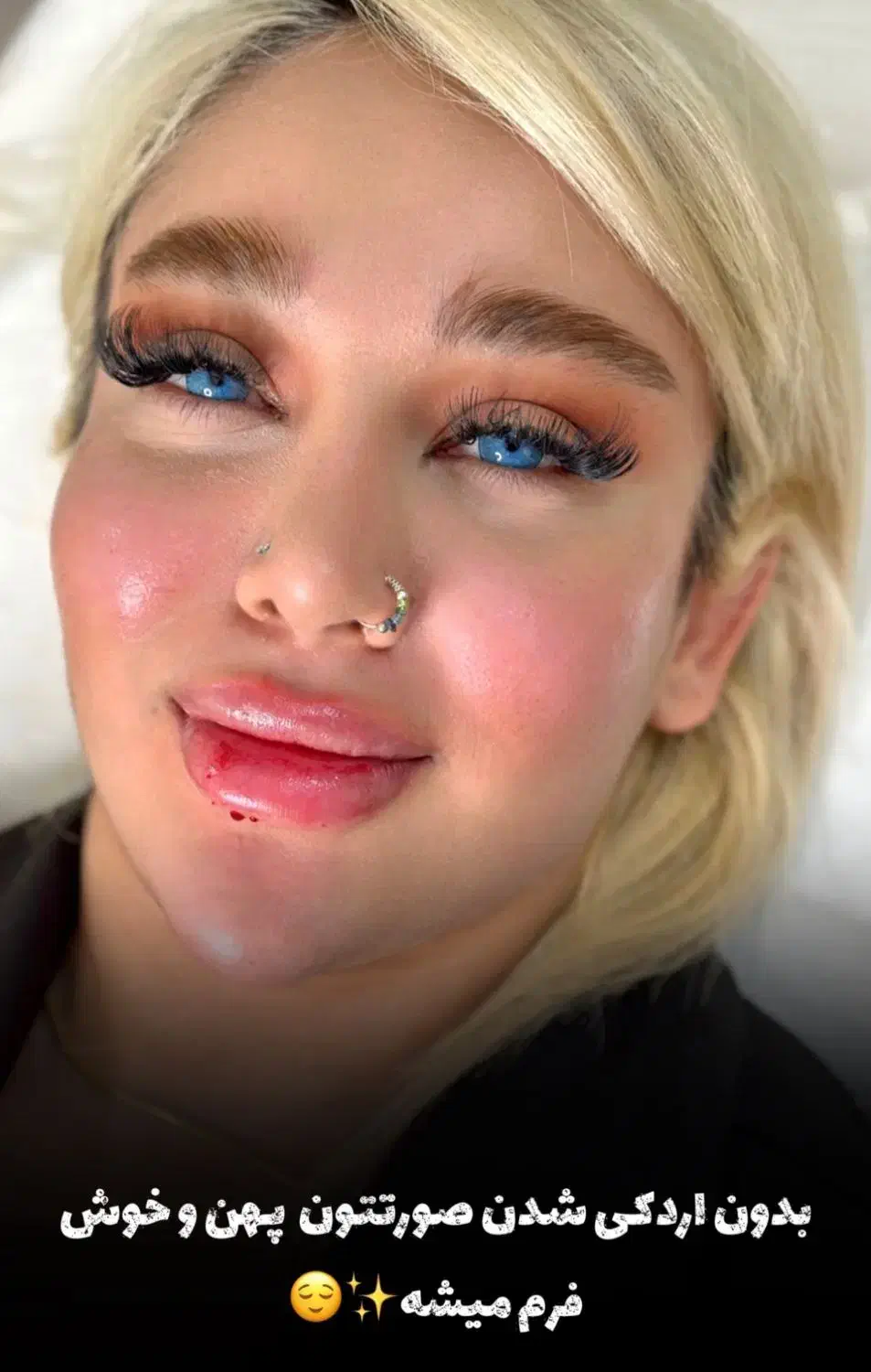 پزشک پوست و زیبایی|استخدام درمانی، زیبایی، بهداشتی|اردبیل, |دیوار