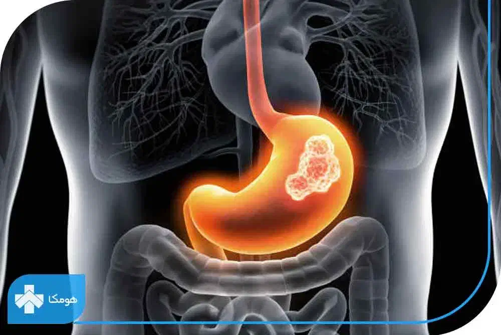 معده|خدمات آرایشگری و زیبایی|آزادشهر, |دیوار