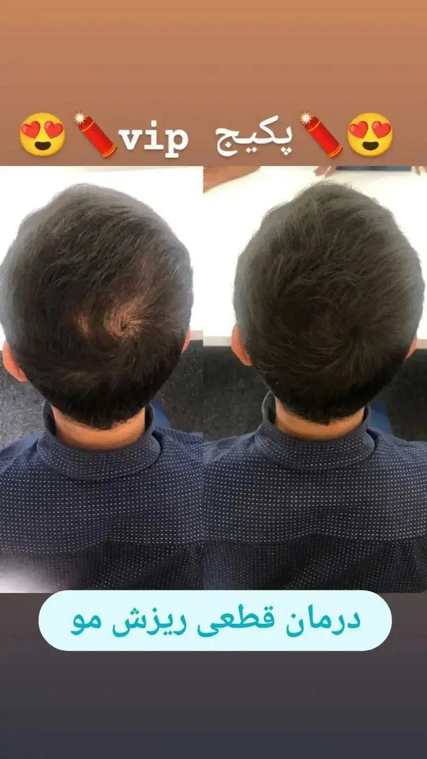 سرم سیر سیاه(قطع ریزش مو تضمینی)|آرایشی، بهداشتی، درمانی|تبریز, |دیوار