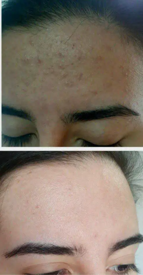کرم لایه بردار روشن کننده لیفت کننده|آرایشی، بهداشتی، درمانی|مشهد, فدک|دیوار