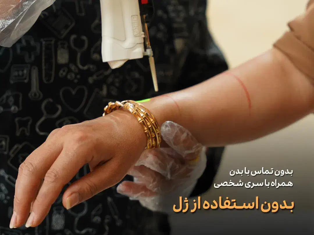 لیزر موهای زائد کل بدن فقط با 590|خدمات آرایشگری و زیبایی|کرمانشاه, |دیوار