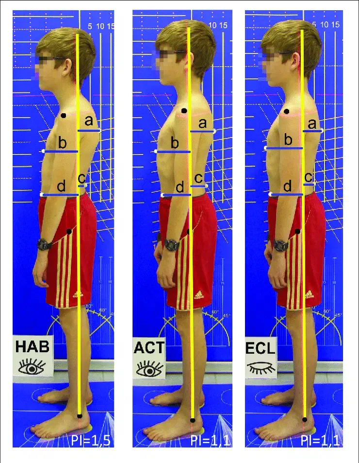حرکت اصلاحی و آنالیز اسکلتی عضلانی|خدمات آموزشی|اصفهان, سعادتآباد|دیوار