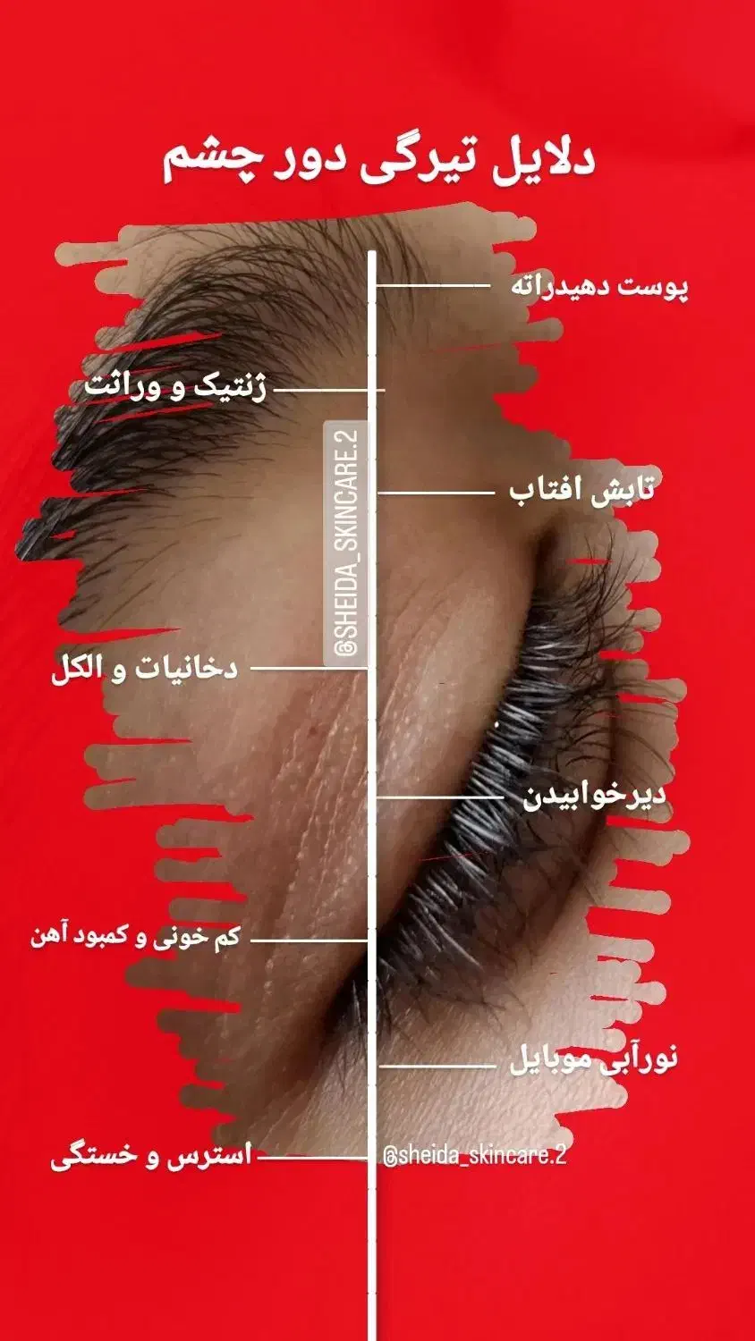 فیشال صورت بانوان و آقایان محترم و فیشال بادی|خدمات آرایشگری و زیبایی|اصفهان, دشتستان|دیوار