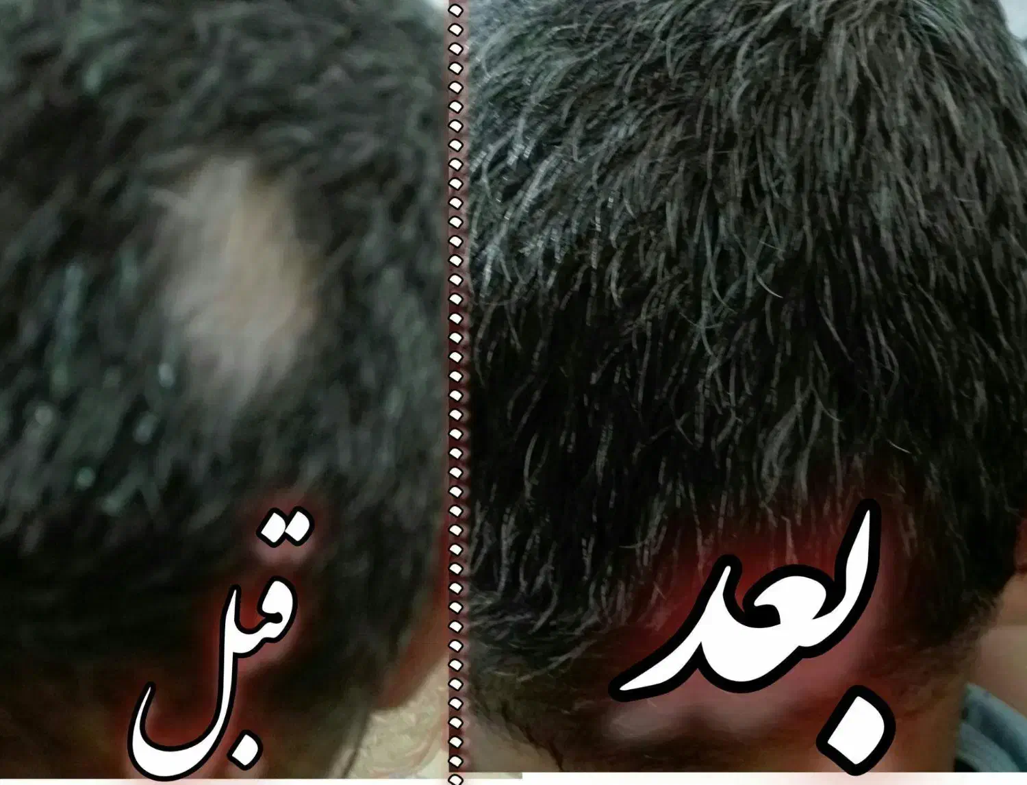 پرپشت شدن مو و رویش موی جدید|آرایشی، بهداشتی، درمانی|گناباد, |دیوار