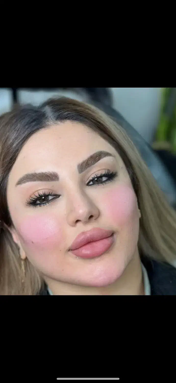 اف یلدایی ژل و بوتاکس|خدمات آرایشگری و زیبایی|اهواز, کوی ملی راه|دیوار