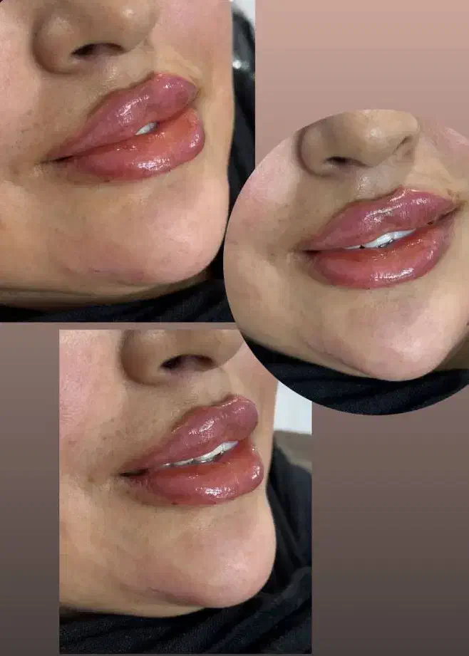 تخفیف اموزش فیلر و پیرسینگ و چال گونه و میکرودرمال|خدمات آرایشگری و زیبایی|محمدیه-قزوین, |دیوار