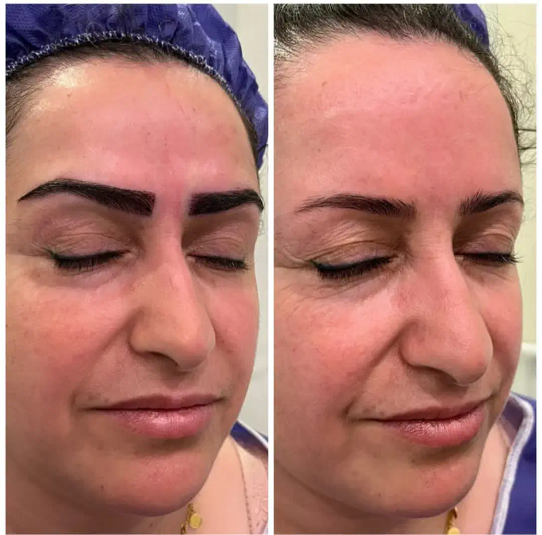 میکروکاشت ابرو 16 میلیون|خدمات آرایشگری و زیبایی|ابهر, |دیوار