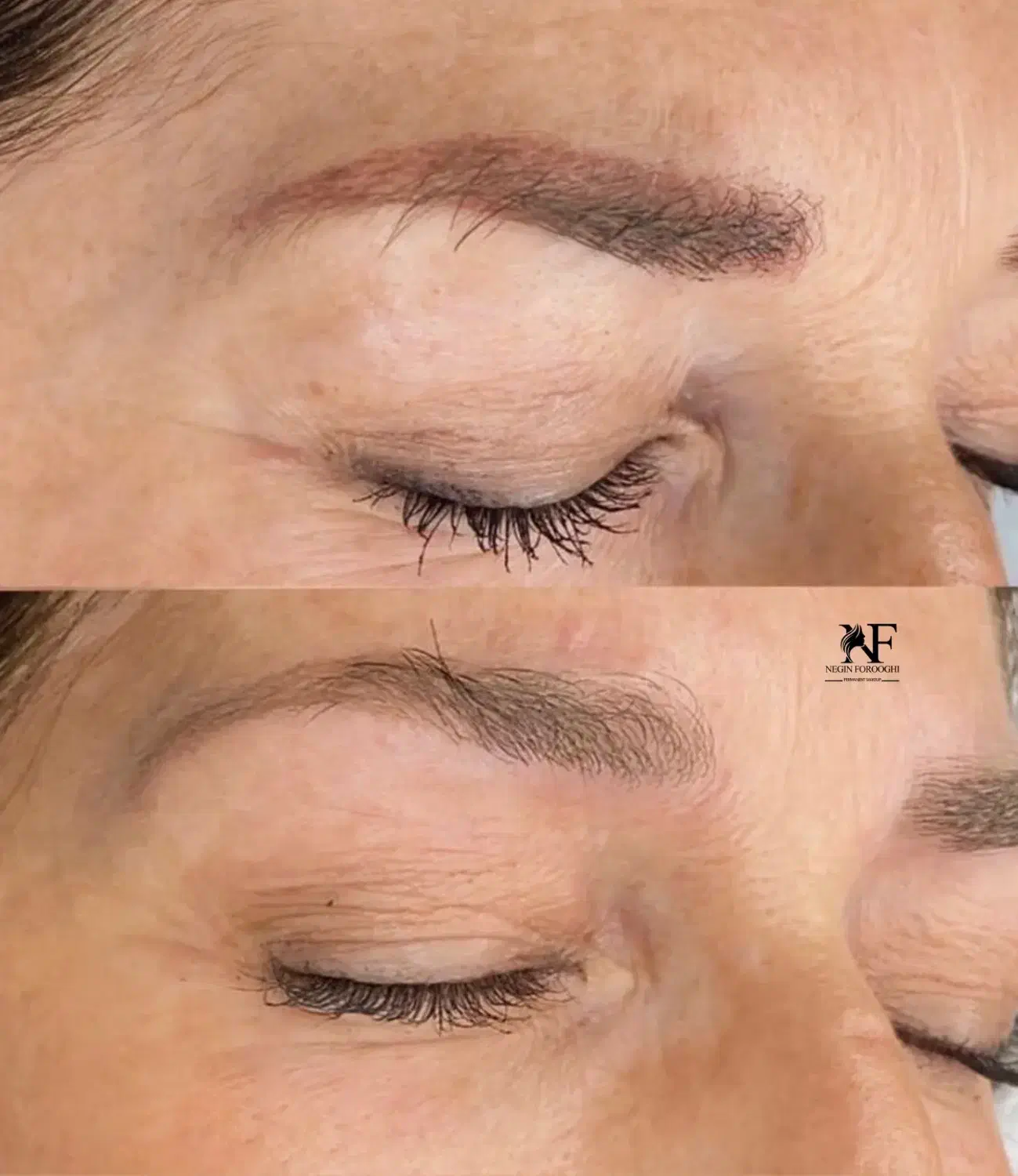 ریموو تک‌جلسه ای با رجووی اصل ومیکروبلیدینگ شیدینگ|خدمات آرایشگری و زیبایی|رشت, لاکانی|دیوار