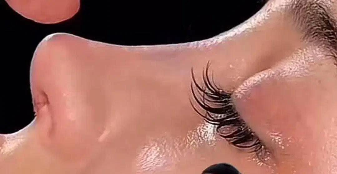 تخفیف ویژه عمل بینی|خدمات آرایشگری و زیبایی|تهران, آذربایجان|دیوار