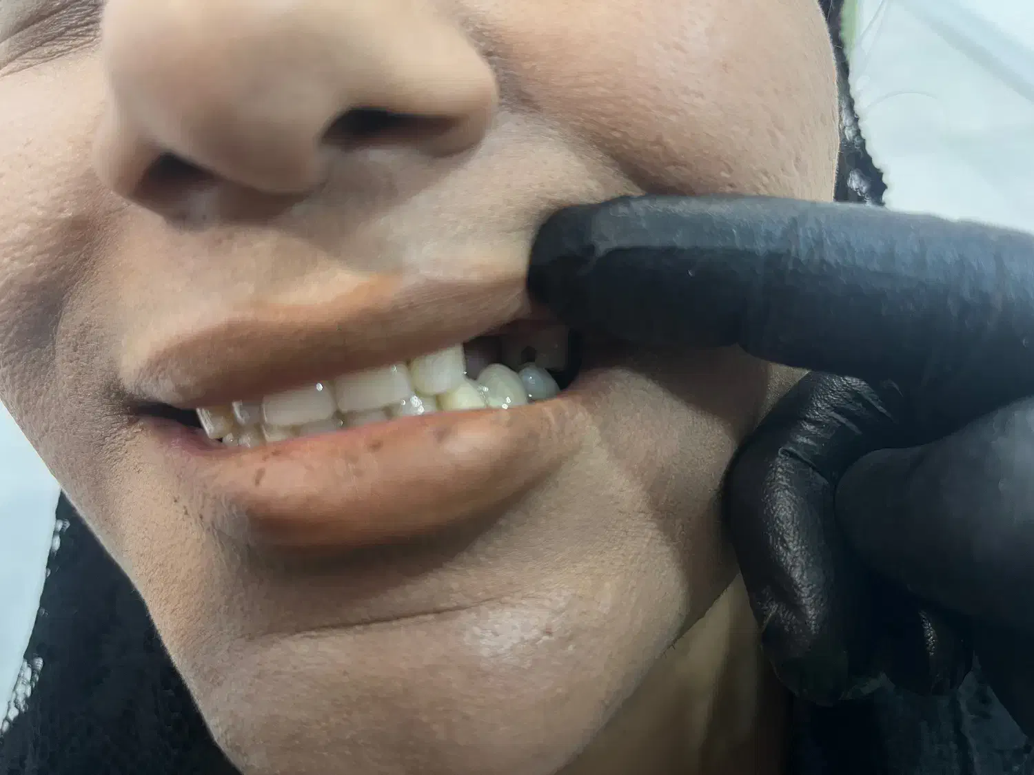 خدمات دندانسازی مروارید|خدمات آرایشگری و زیبایی|دهدشت, |دیوار