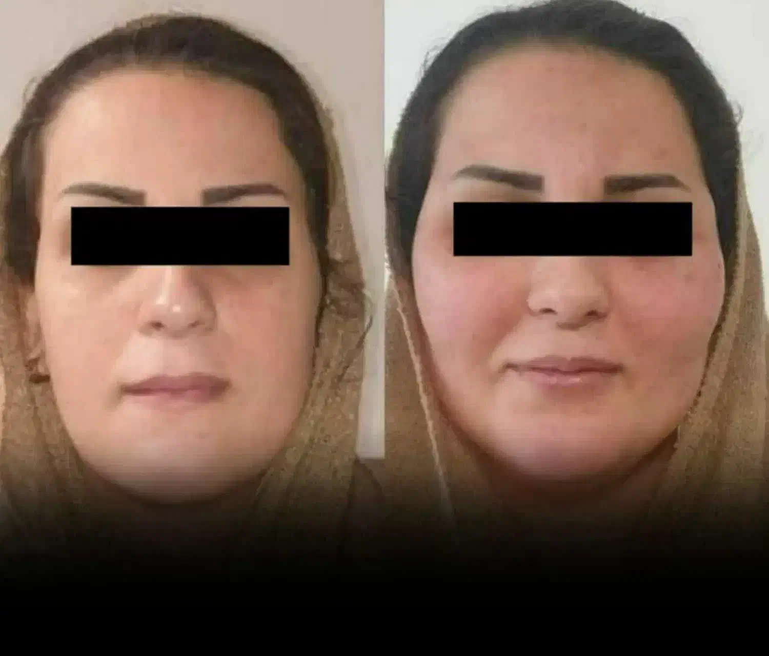 پودر جوانه گندم بین استار چاقی صورت100%تضمینی|خوردنی و آشامیدنی|اهواز, سپیدار|دیوار