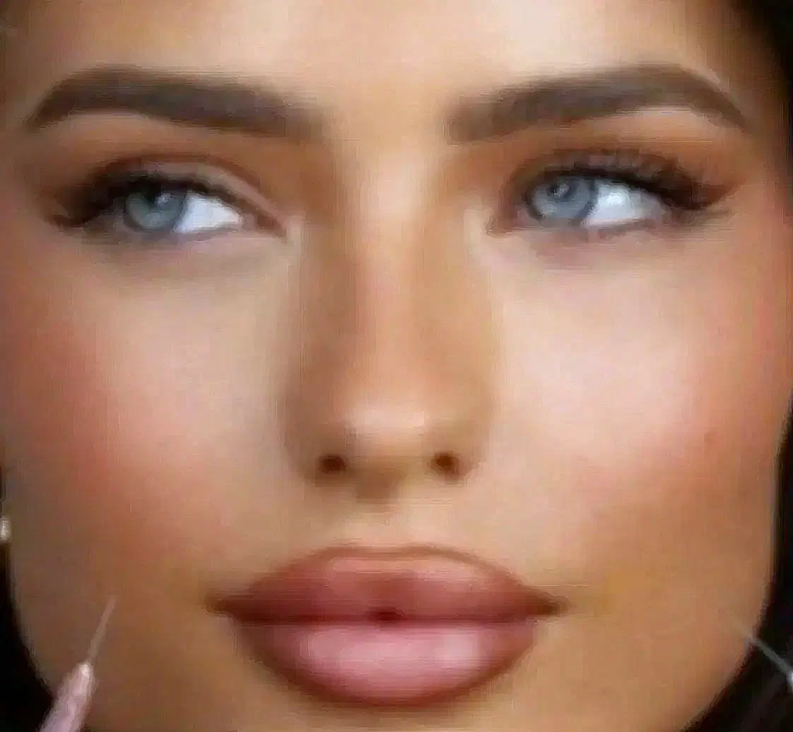 فیلرچانه ولب تزریق ژل لیزرمادلینگ پزشک|خدمات زیبایی و سلامت|تهران, صادقیه|دیوار