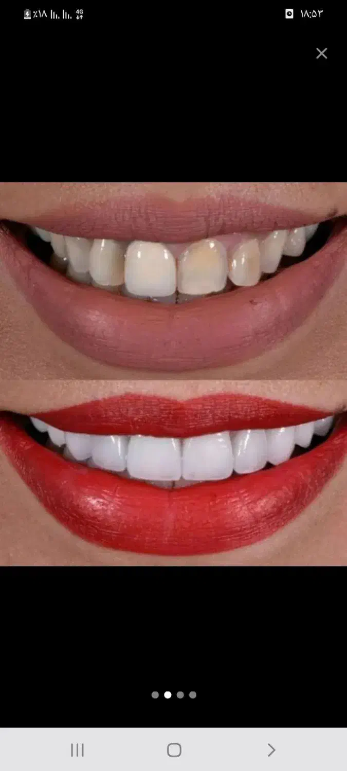 برطرف کردن تمام عیوب دندان|آرایشی، بهداشتی، درمانی|سیرجان, |دیوار