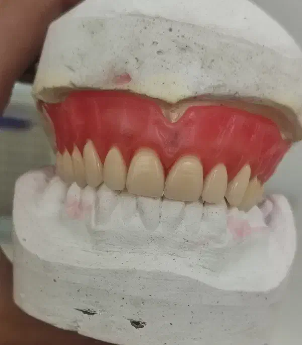 ( دندان سازی لبخند )|خدمات آرایشگری و زیبایی|زنجان, |دیوار