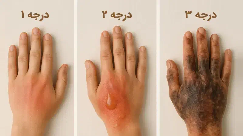 بهترین جراح و کارشناس زخم ایران|خدمات آرایشگری و زیبایی|تهران, جهاد|دیوار