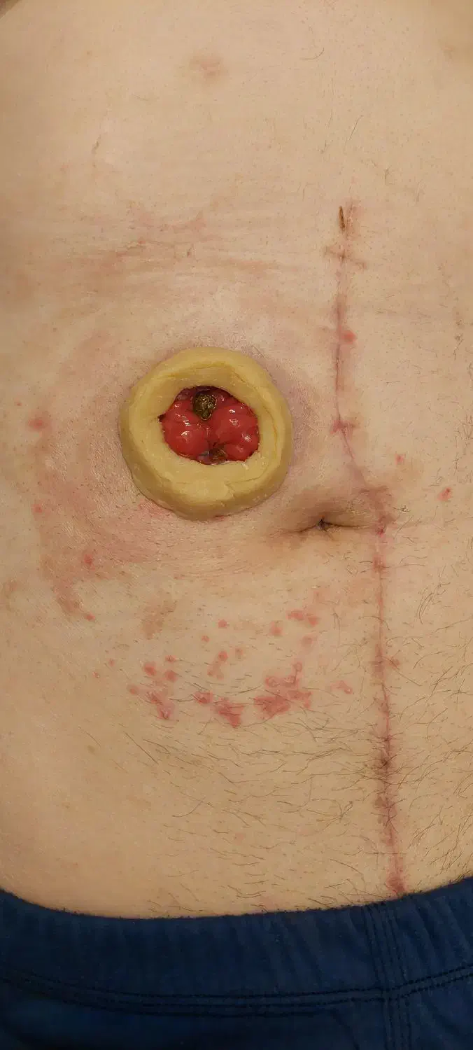 تزریقات و سرم تراپی در منزل|خدمات آرایشگری و زیبایی|خوی, |دیوار