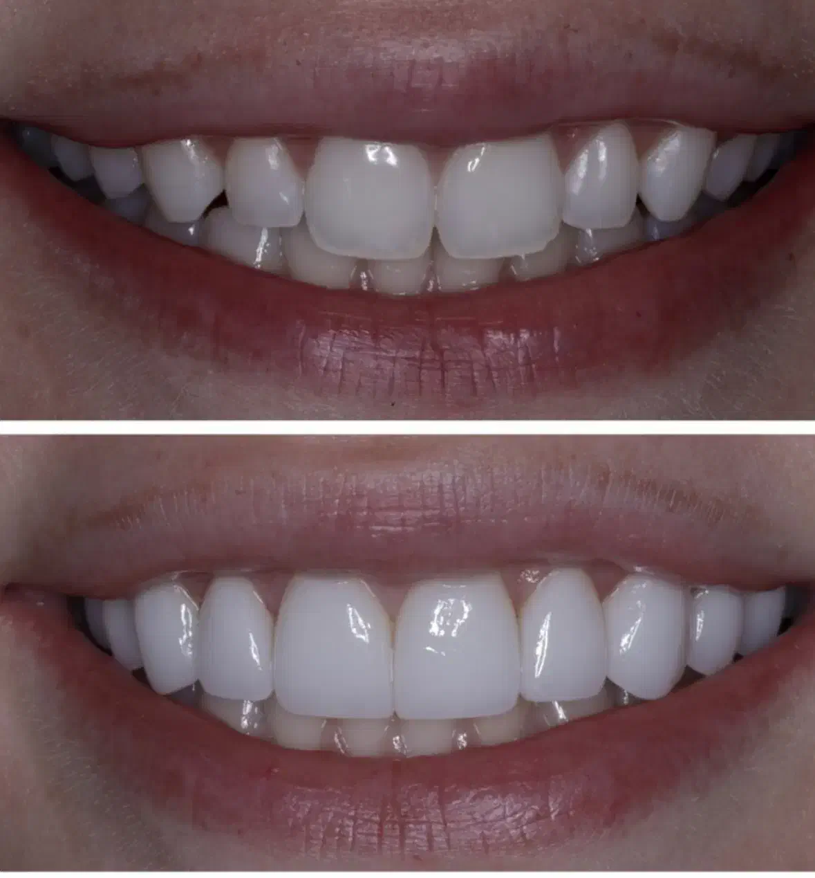 بمب تخفیف واقعی ۳۵٪ دندانپزشکی تا پایان سال|خدمات آرایشگری و زیبایی|فلاورجان, |دیوار