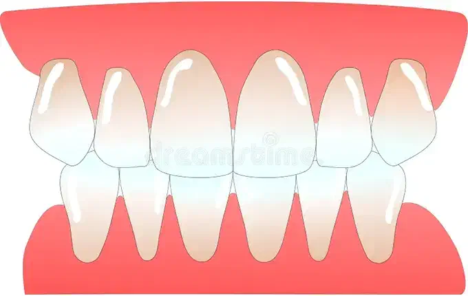 عصب کشی /دندان پزشکی|خدمات آرایشگری و زیبایی|شیراز, گلکوب|دیوار