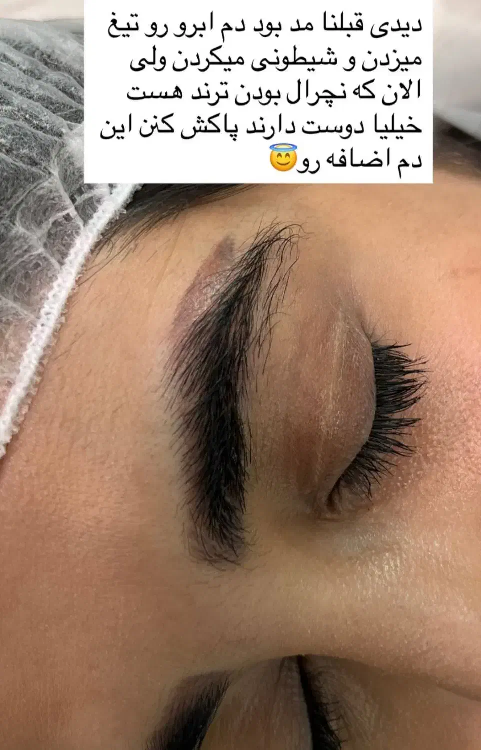 ریموو تک جلسه  با تخفیف ویژه|خدمات آرایشگری و زیبایی|تربت جام, پاسداران|دیوار