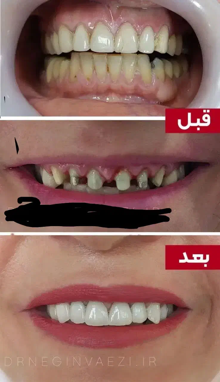 دندانپزشکی صدف (با شرایط اقساط) کامپوزیت|خدمات آرایشگری و زیبایی|قم, حقیقت|دیوار