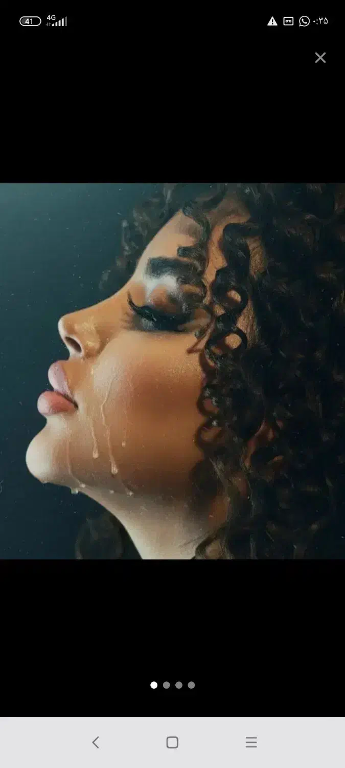 تزریق ژل و بوتاکس تزریق چربی|خدمات آرایشگری و زیبایی|تهران, شهرک ولیعصر جنوبی|دیوار