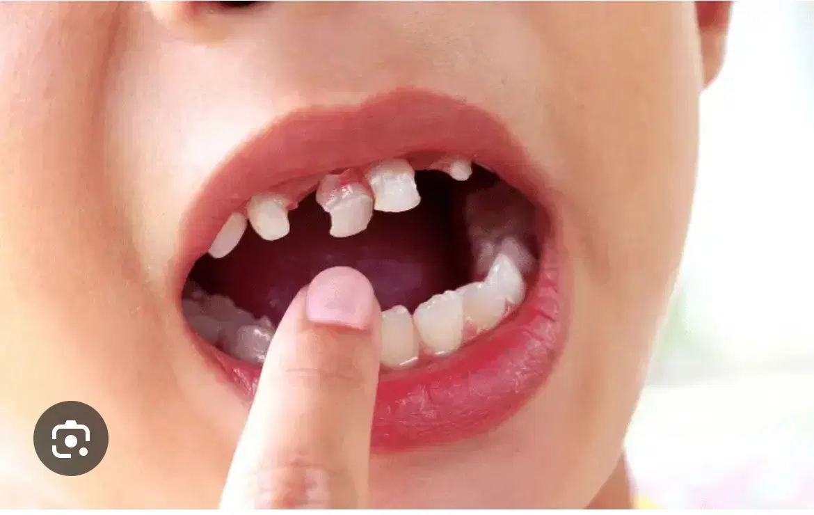 دندانپزشکی اطفال خیریه|خدمات زیبایی و سلامت|تهران, دروس|دیوار