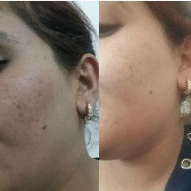 سویق افزایش وزن حتمی|آرایشی، بهداشتی، درمانی|ارومیه, |دیوار