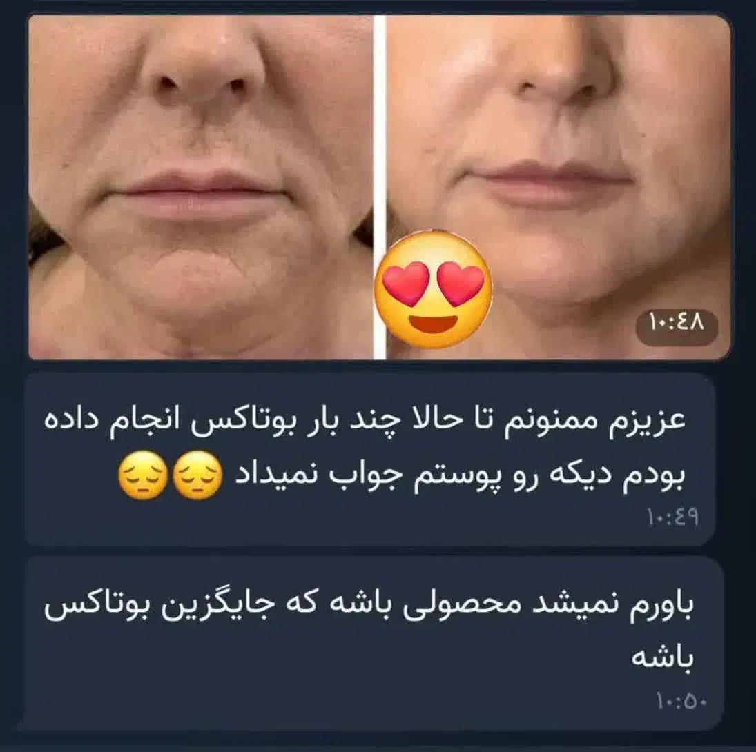 کرم 5 کاره|آرایشی، بهداشتی، درمانی|شیراز, میانرود|دیوار