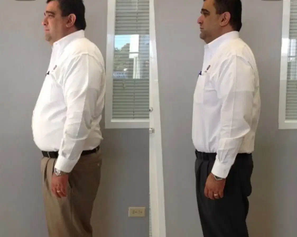 لاغری با بدون عوارض|آرایشی، بهداشتی، درمانی|تبریز, |دیوار