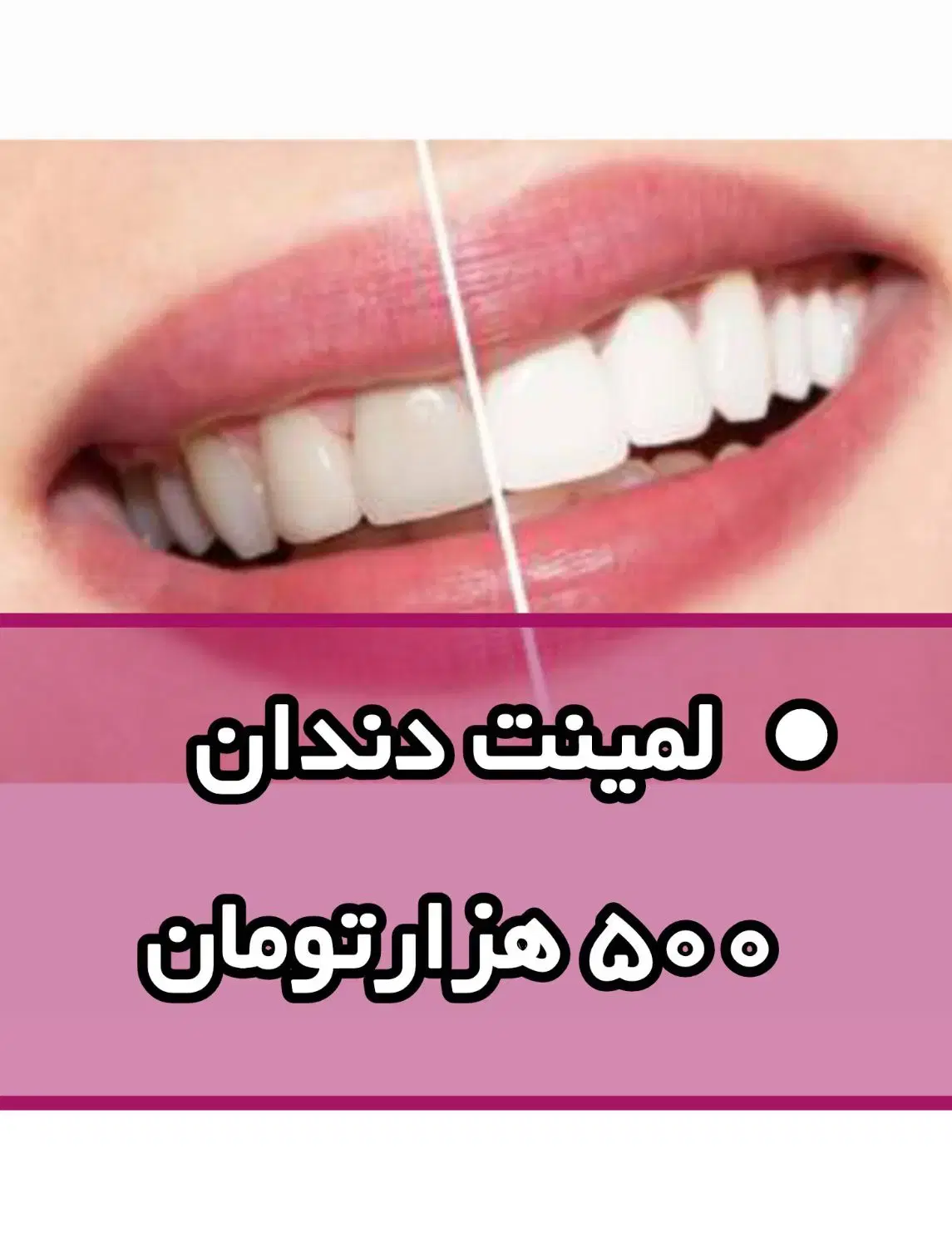 میانومیMM|تخت و صندلی بچه|گرگان, |دیوار