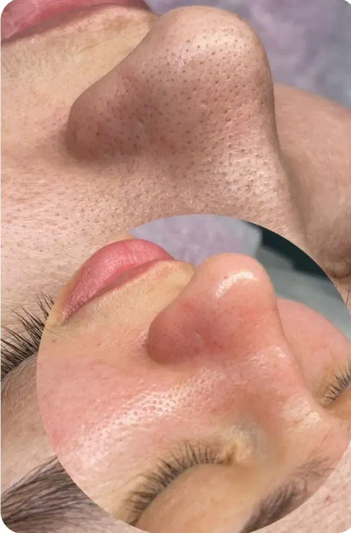 پاکسازی پکیج ویژه|خدمات آرایشگری و زیبایی|تربتحیدریه, مظفریه|دیوار