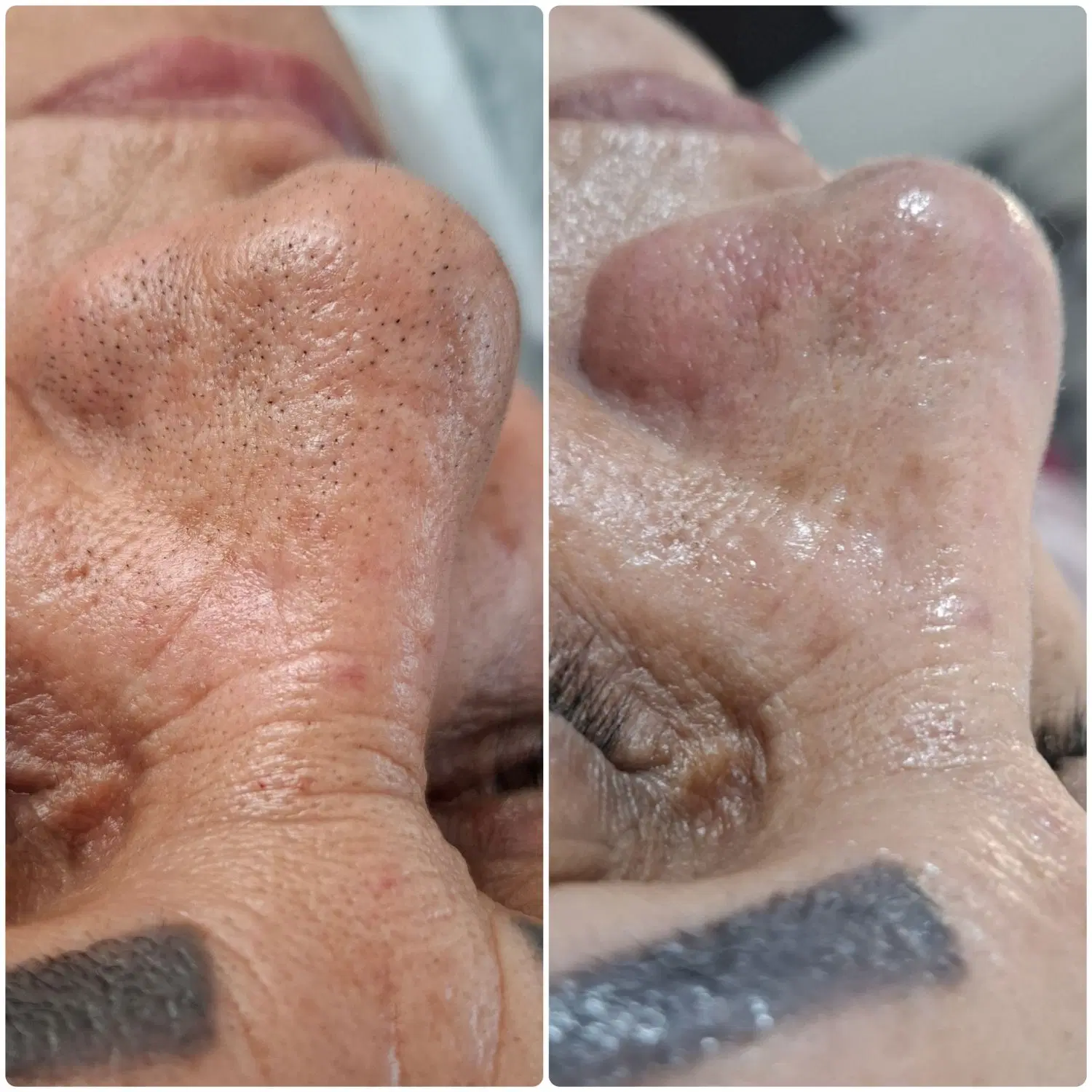 پاکسازی و فیشال تخصصی پوست در شهرری|خدمات زیبایی و سلامت|تهران, فیروزآبادی|دیوار