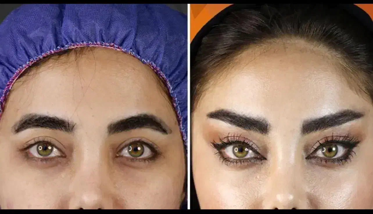 جشنواره تخفیف جراحی زیبایی شقیقه،بلفارو،دایرکت|خدمات آرایشگری و زیبایی|پرند, فاز ۲|دیوار