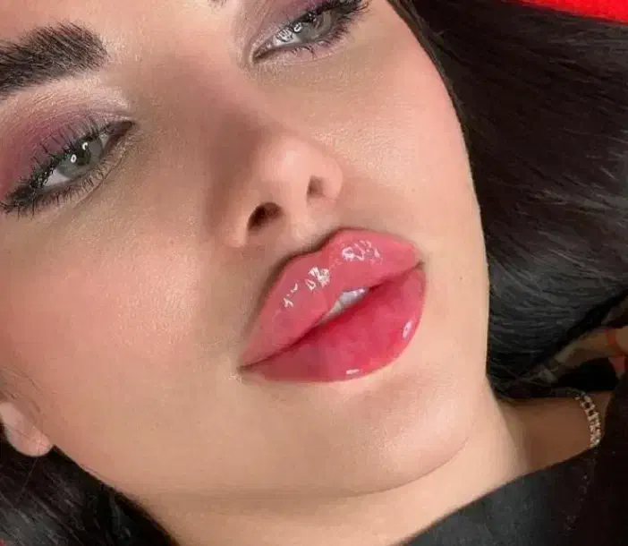 جشنواره ژل لب فیلر زیرچشم،شقیقه،بوتاکس،کلینیک پزشک|خدمات آرایشگری و زیبایی|کرج, گوهردشت|دیوار