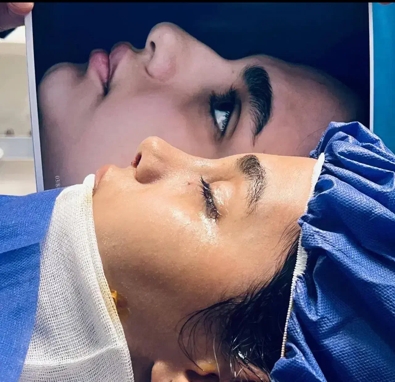 عمل جراحی بینی 27.900تومان/ بهترین متخصص کرج|خدمات آرایشگری و زیبایی|کرج, فاز ۱ مهرشهر|دیوار