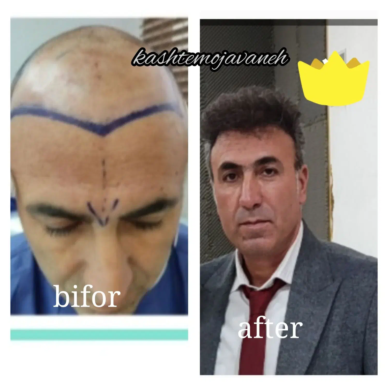 جشنواره یلدایی کاشت موشیرازی از۱۳تومن|خدمات آرایشگری و زیبایی|تهران, صد دستگاه|دیوار