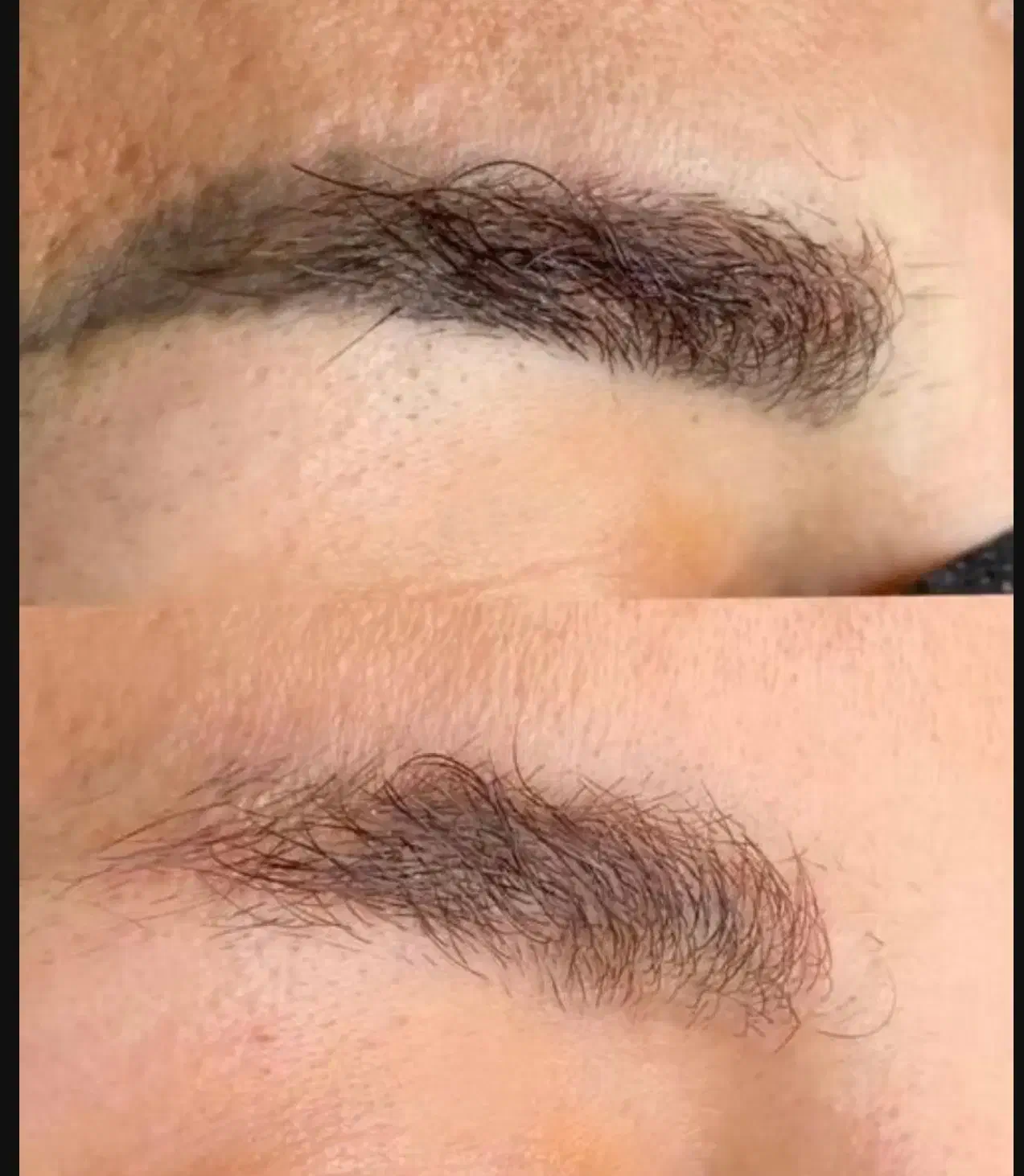 ریموو تاتو تک جلسه ای|خدمات آرایشگری و زیبایی|تربتحیدریه, طالقانی|دیوار