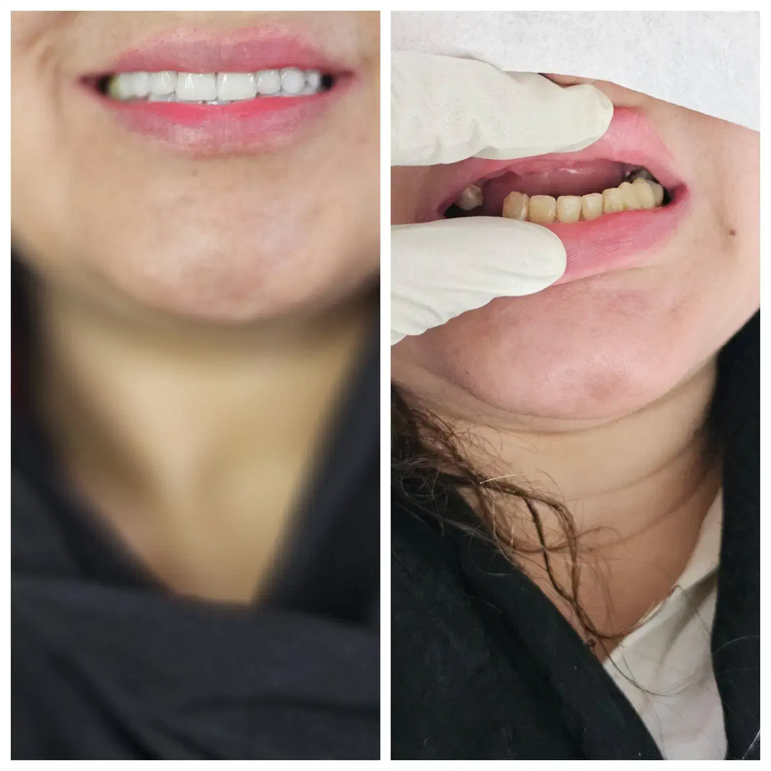 مرکز تخصصی دندانسازی اسپی دنتال|خدمات آرایشگری و زیبایی|خرمآباد, |دیوار