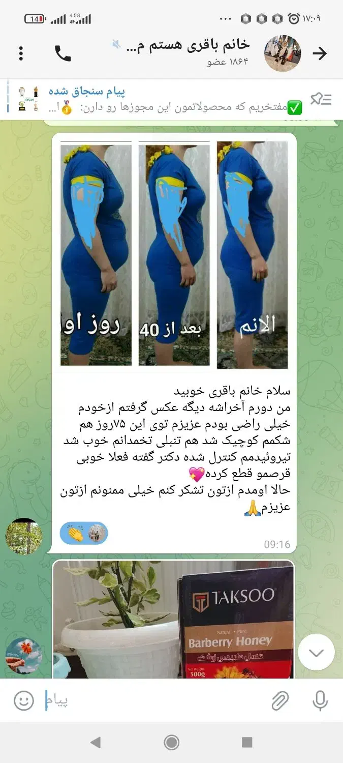 چربی سوزی ولاغری وزیبایی صورت|آرایشی، بهداشتی، درمانی|ایلام, |دیوار