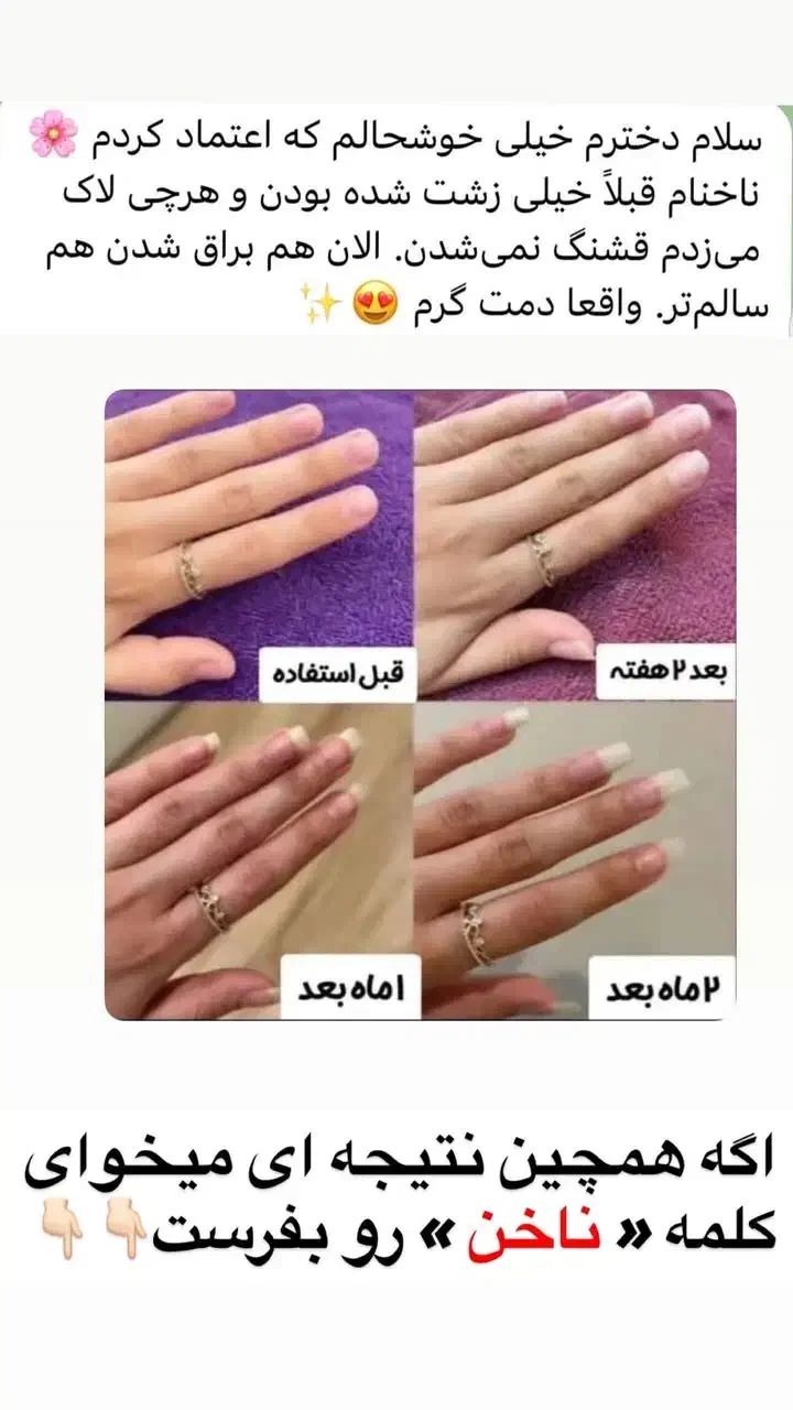 ناخنت میشکنه بیا برات درستش کنم|آرایشی، بهداشتی، درمانی|تیران, |دیوار