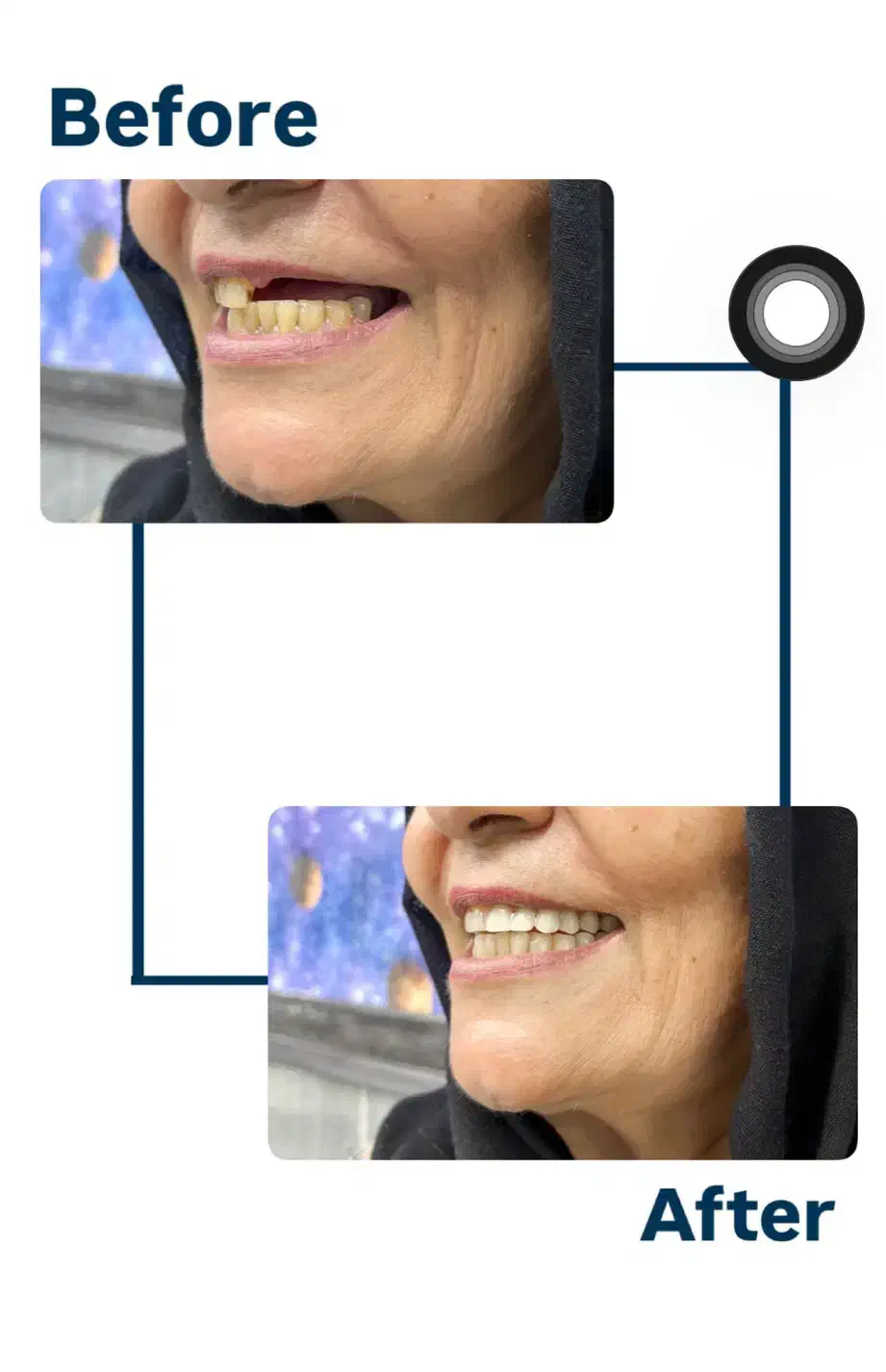 بلک فرایدی دندان مصنوعی دندانسازی اقساط بیمه ها|خدمات آرایشگری و زیبایی|کرمان, |دیوار