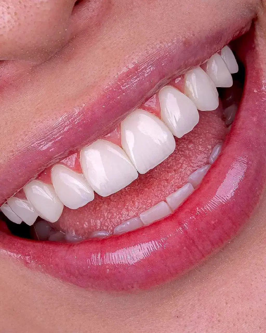 لبخند نو|خدمات آرایشگری و زیبایی|مشهد, جنت|دیوار