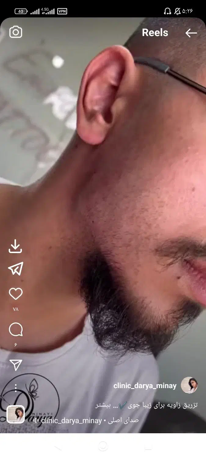 تخفیف ویژه پاییزی|خدمات آرایشگری و زیبایی|مهاباد (آذربایجان غربی), |دیوار