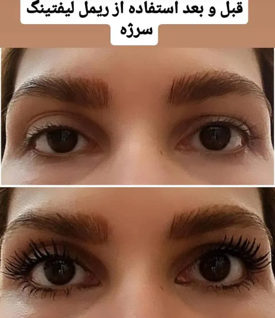 فروش محصولات بهداشتی درمنزل|استخدام بازاریابی و فروش|قزوین, |دیوار