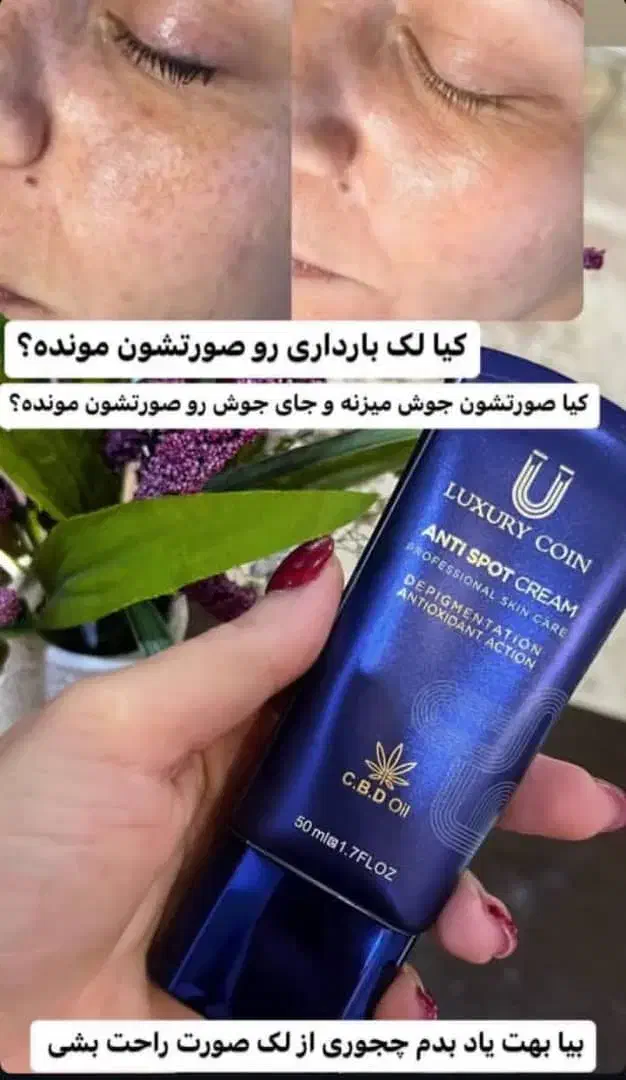 جوانی تو هدیه بگیر|آرایشی، بهداشتی، درمانی|مینودشت, |دیوار